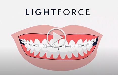 Lightforce O'Neill Orthodontics in New Freedom, PA